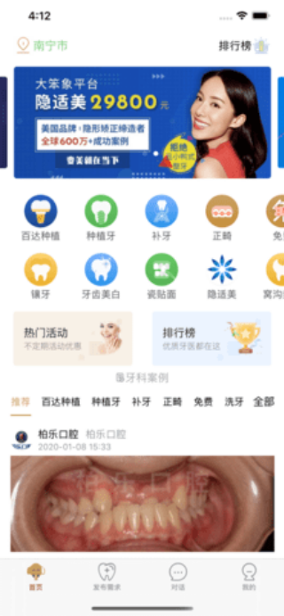 大笨象